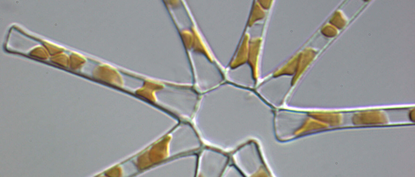 Asterionella Formosa (47 x 5,1 Mikrometer)